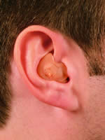 In The Ear (ITE) Hearing Aid